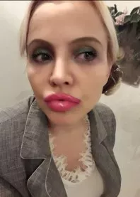 ��������� ����� ��������