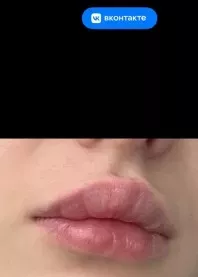 ��� 