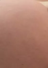���
