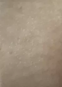 ����